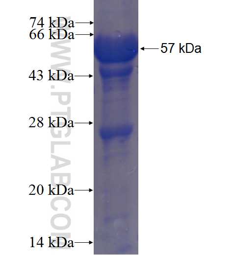 SULT6B1 fusion protein Ag23385 SDS-PAGE