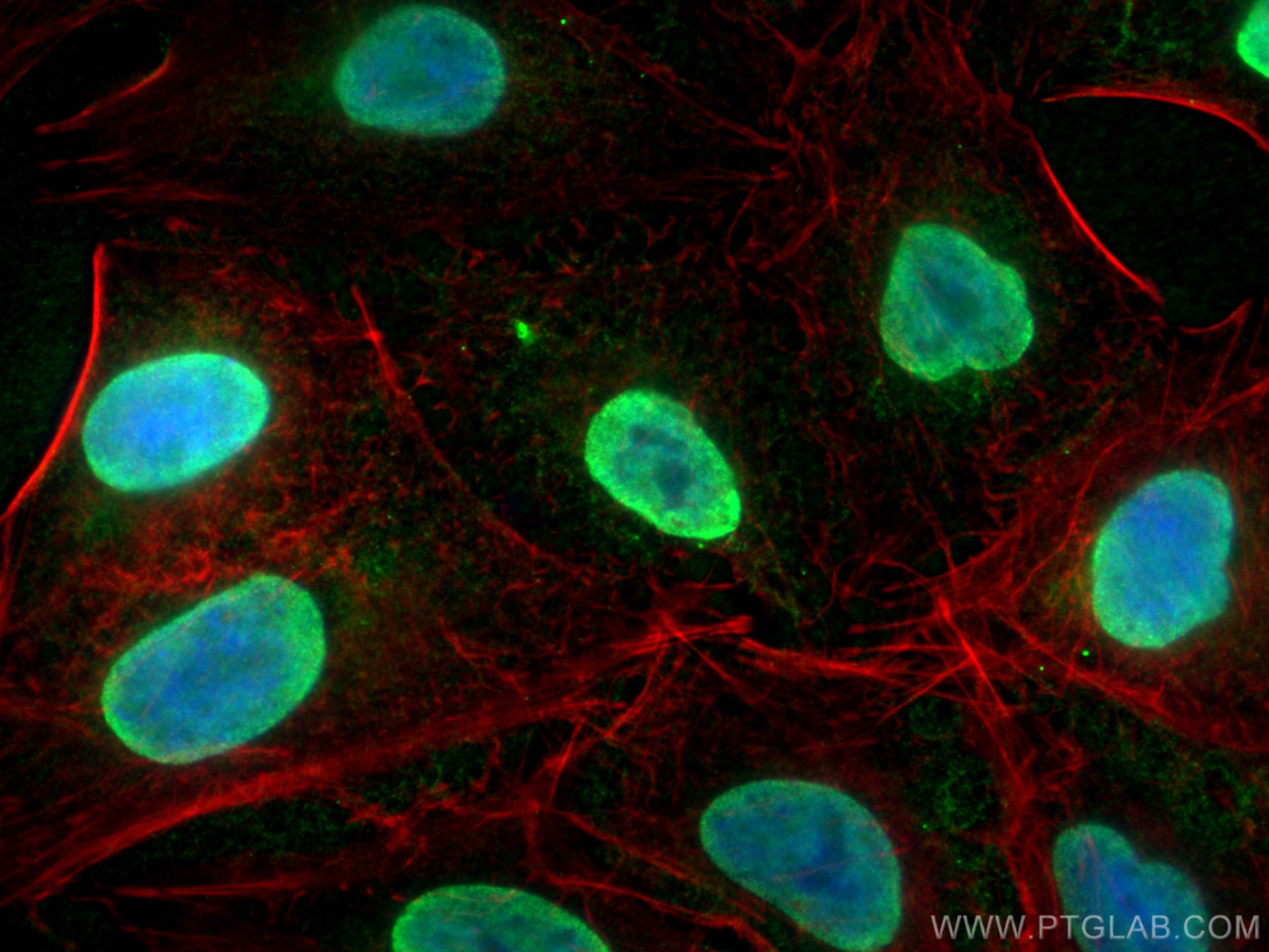 Immunofluorescence (IF) / fluorescent staining of A549 cells using SUMO1 Monoclonal antibody (67559-1-Ig)