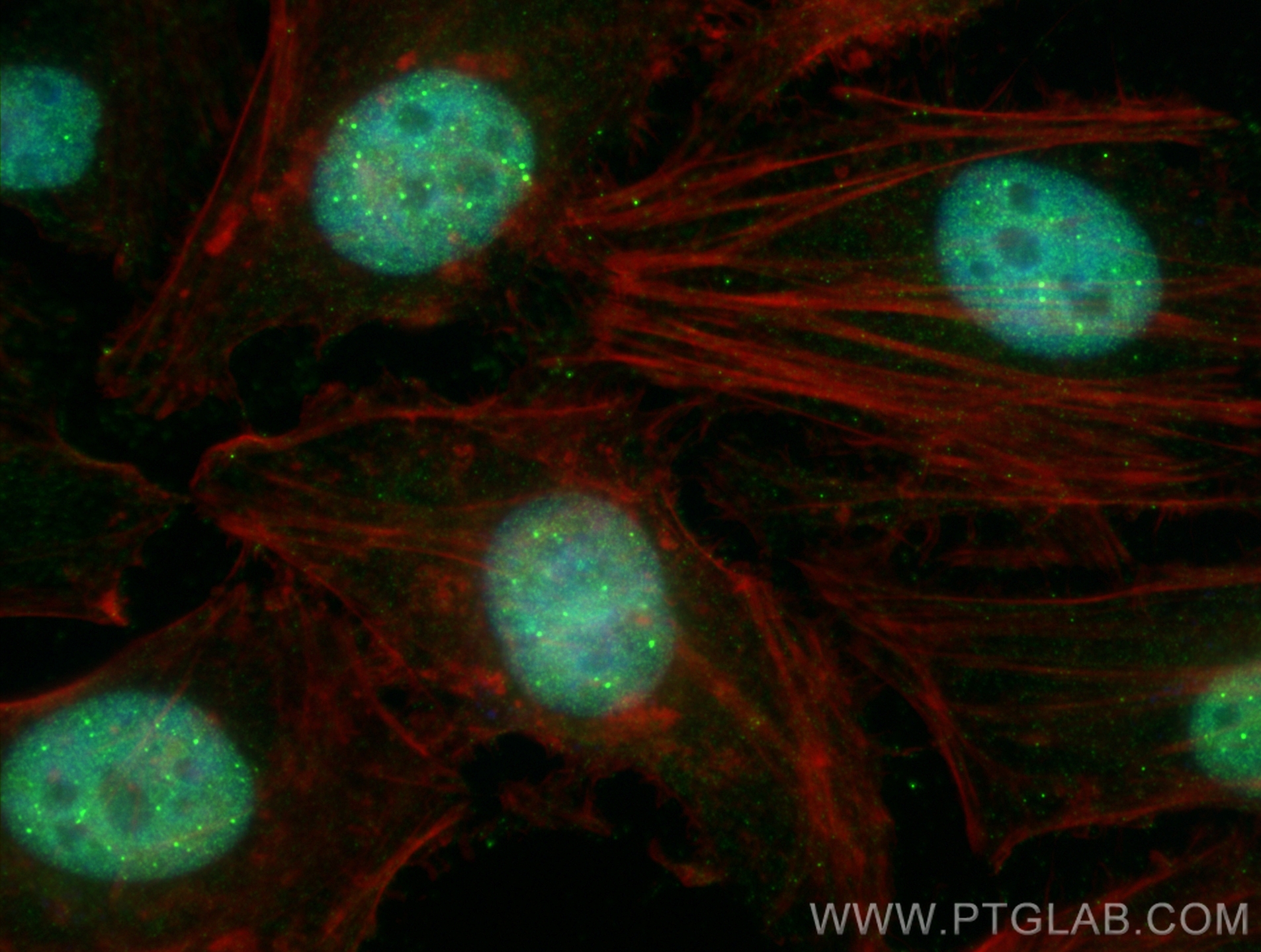 Immunofluorescence (IF) / fluorescent staining of HeLa cells using SUMO2/3 Monoclonal antibody (67154-1-Ig)