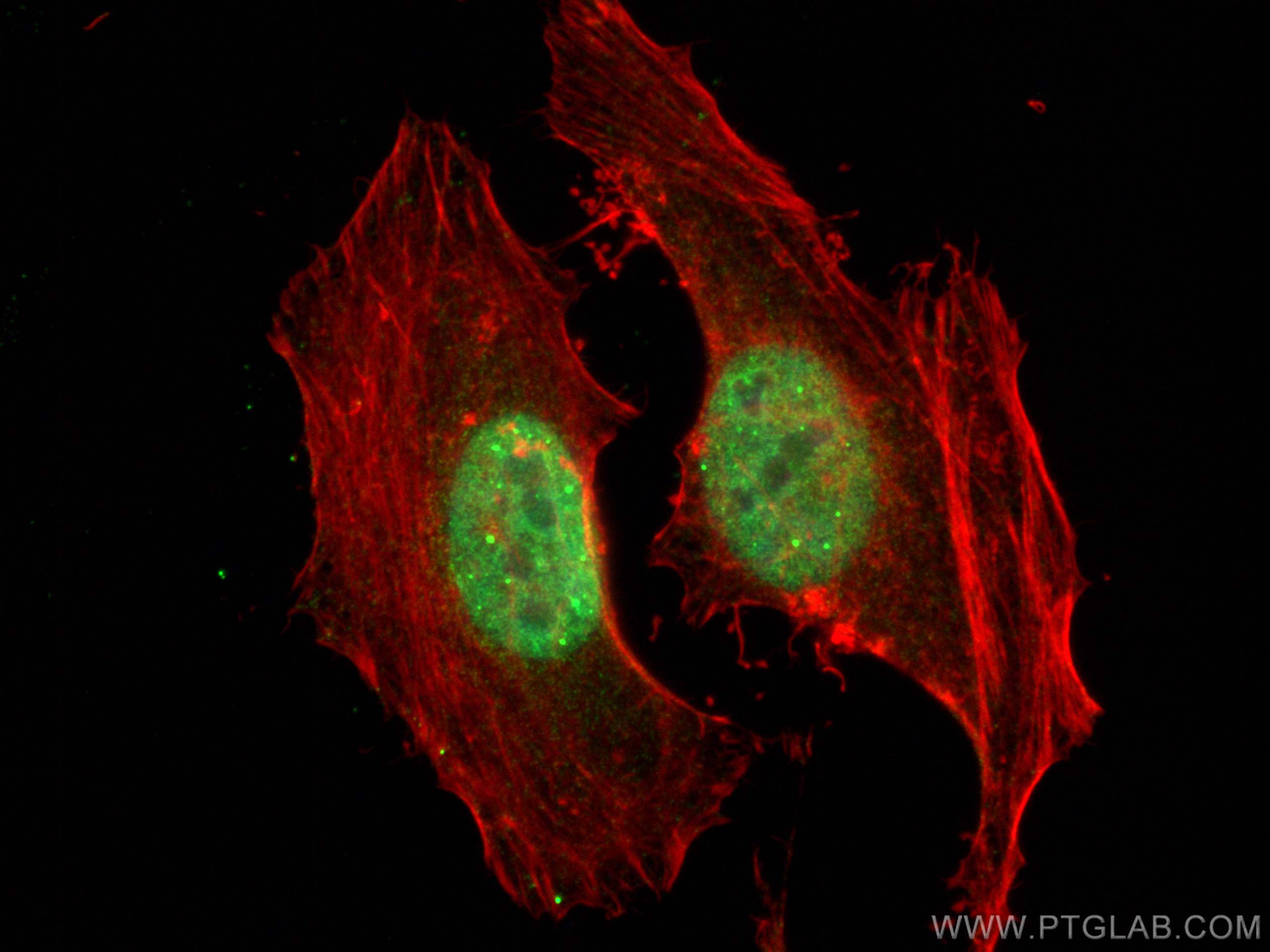 Immunofluorescence (IF) / fluorescent staining of HeLa cells using SUMO2/3 Polyclonal antibody (10947-1-AP)