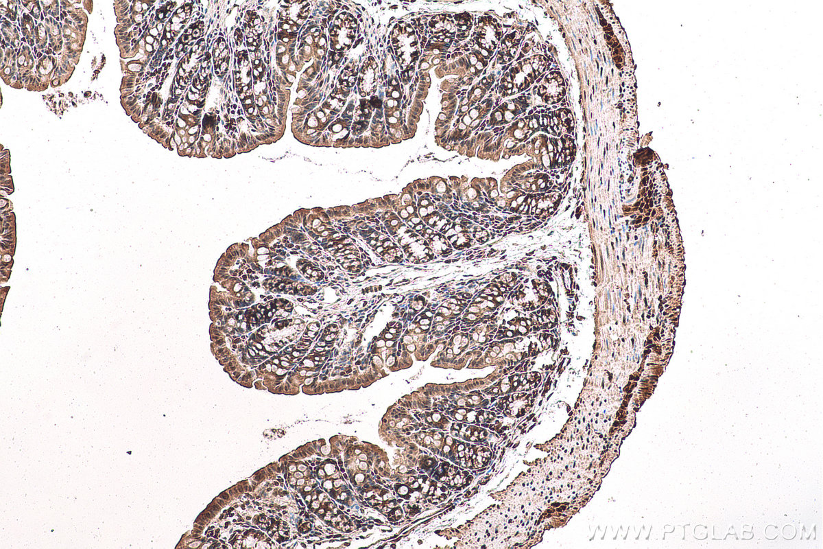 Immunohistochemistry (IHC) staining of mouse colon tissue using SUMO2/3 Polyclonal antibody (11251-1-AP)