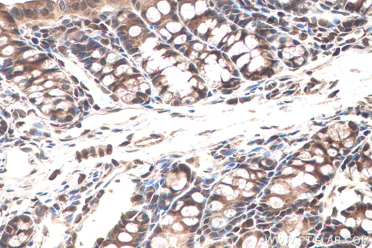 Immunohistochemistry (IHC) staining of mouse colon tissue using SUMO2/3 Polyclonal antibody (11251-1-AP)