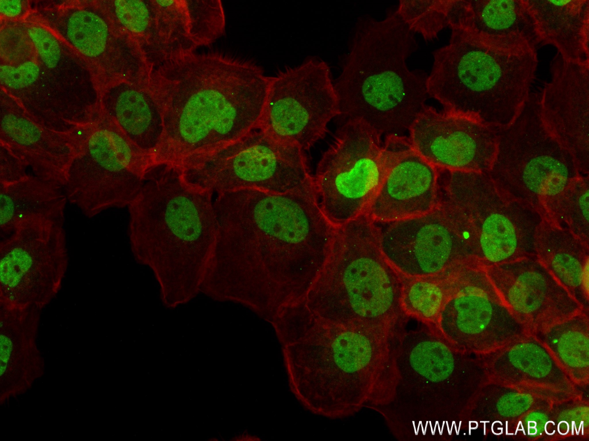 Immunofluorescence (IF) / fluorescent staining of A431 cells using SUMO2/3  Recombinant antibody (84017-5-RR)