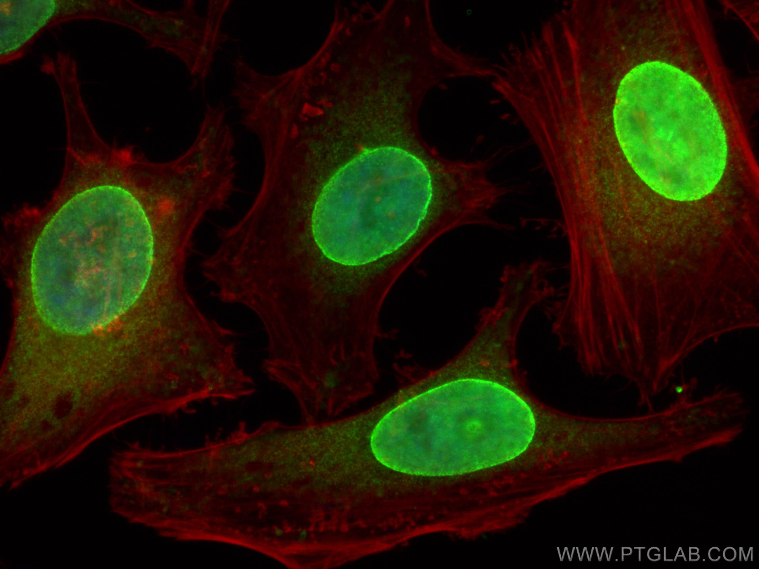 Immunofluorescence (IF) / fluorescent staining of HeLa cells using SUN2 Polyclonal antibody (27556-1-AP)