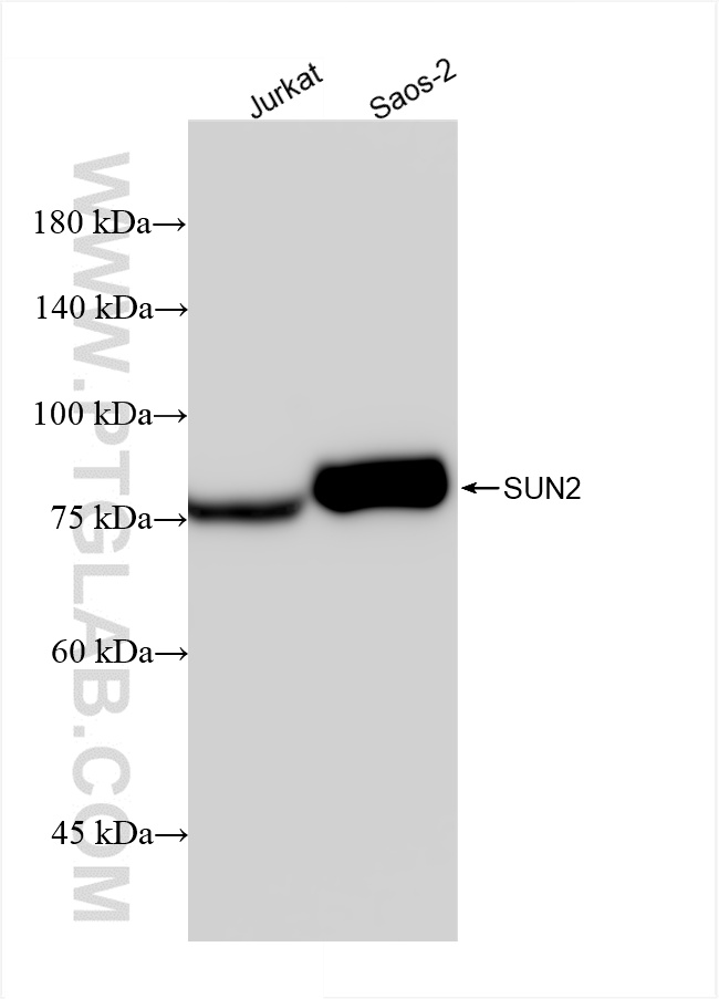 Western Blot (WB) analysis of various lysates using SUN2 Recombinant antibody (85103-3-RR)