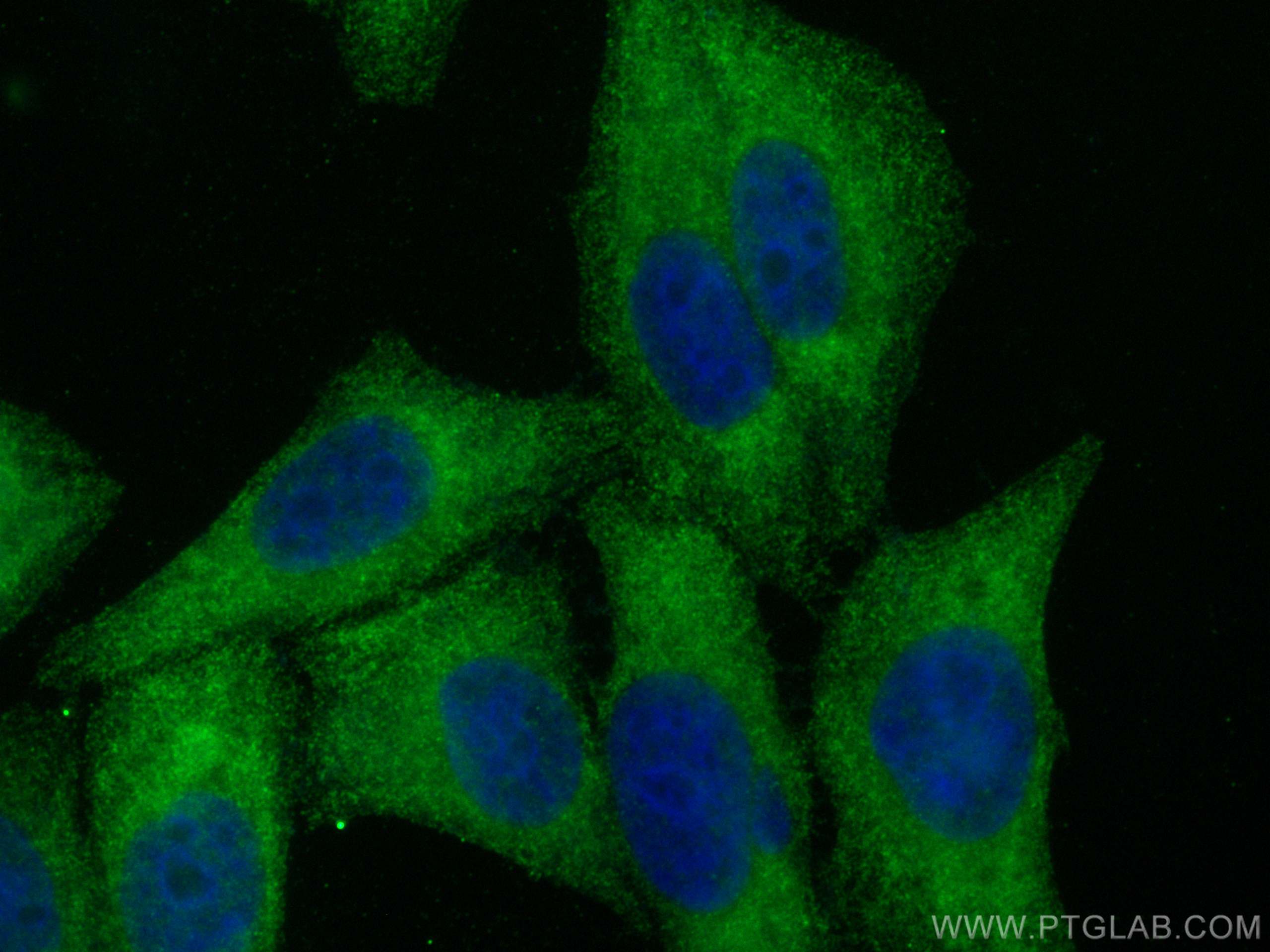 Immunofluorescence (IF) / fluorescent staining of HepG2 cells using SUNC1 Polyclonal antibody (26434-1-AP)