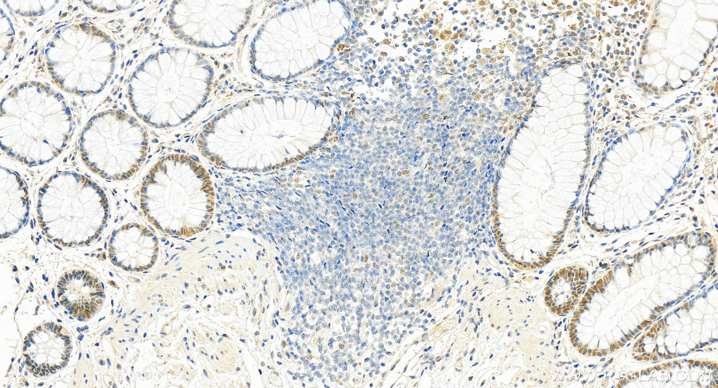 Immunohistochemistry (IHC) staining of human colon tissue using SUPT16H Monoclonal antibody (68243-1-Ig)