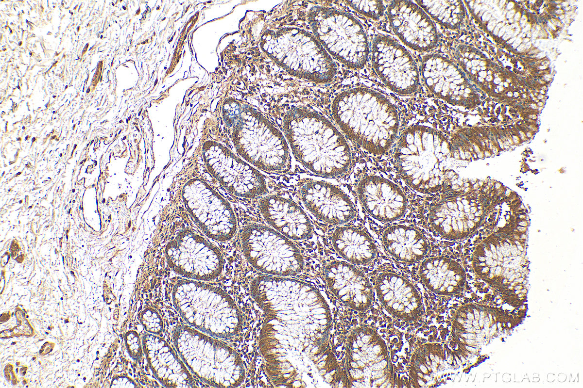 Immunohistochemistry (IHC) staining of human colon tissue using SURF1 Polyclonal antibody (15379-1-AP)