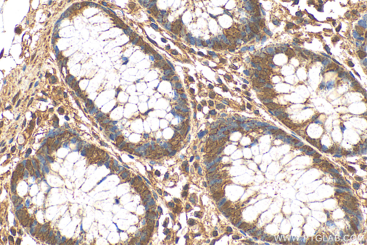 Immunohistochemistry (IHC) staining of human colon tissue using SURF1 Polyclonal antibody (15379-1-AP)