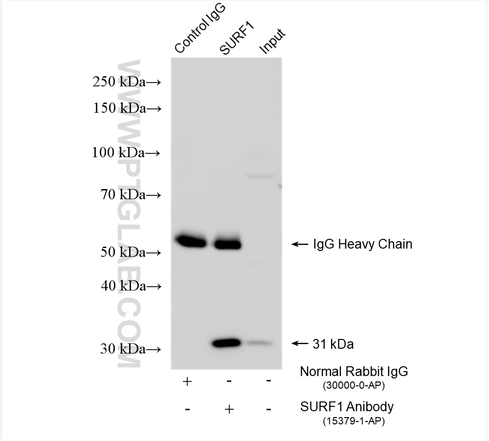 Immunoprecipitation (IP) experiment of HeLa cells using SURF1 Polyclonal antibody (15379-1-AP)