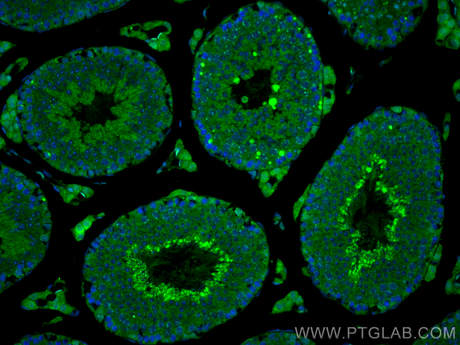 Immunofluorescence (IF) / fluorescent staining of mouse testis tissue using SURVIVIN Polyclonal antibody (10508-1-AP)