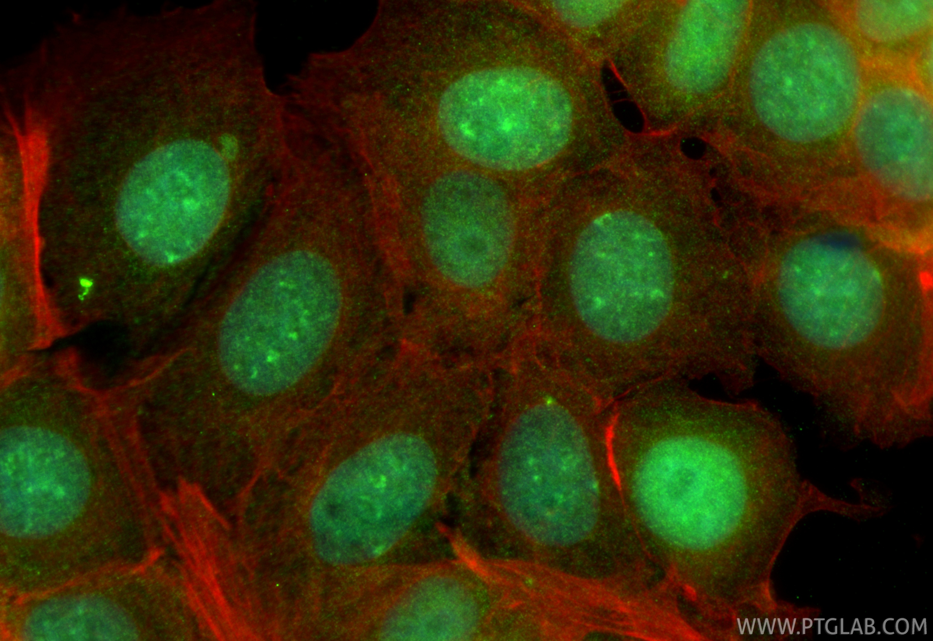 Immunofluorescence (IF) / fluorescent staining of MCF-7 cells using SURVIVIN Polyclonal antibody (10508-1-AP)