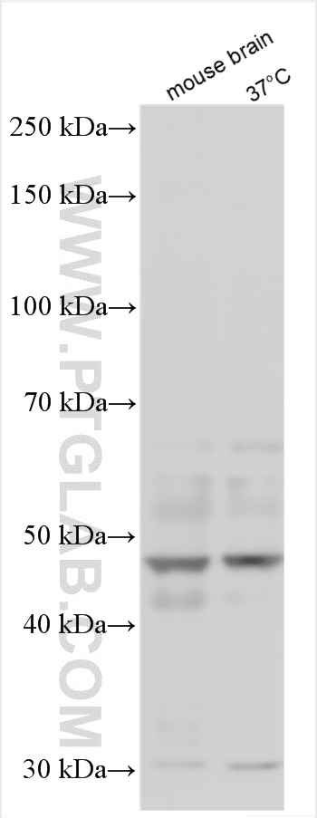 Western Blot (WB) analysis of various lysates using SUSD4 Polyclonal antibody (26829-1-AP)