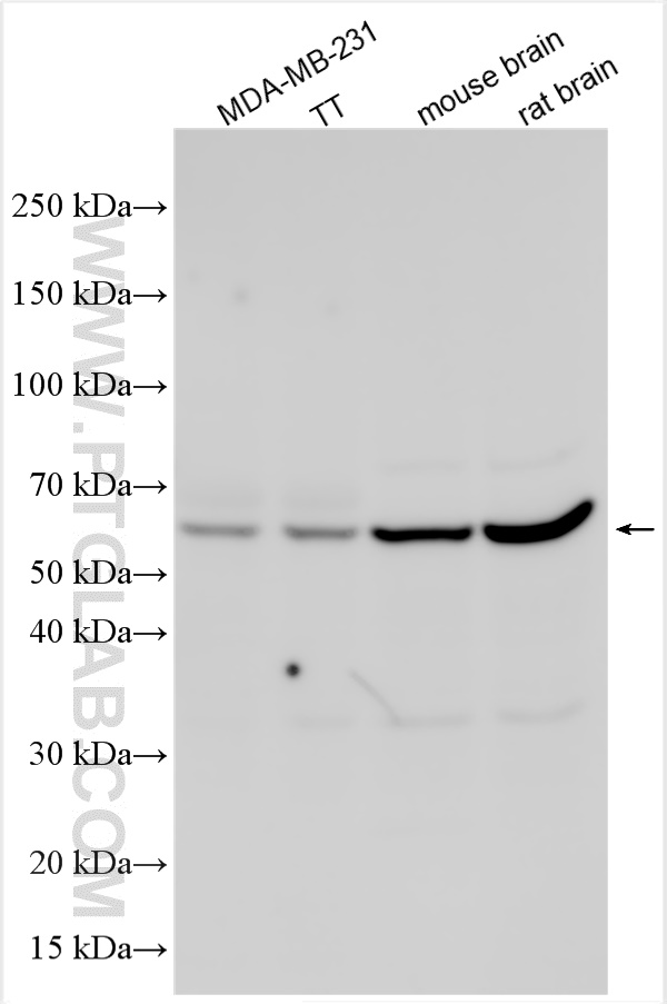 Western Blot (WB) analysis of various lysates using SUSD4 Polyclonal antibody (26829-1-AP)