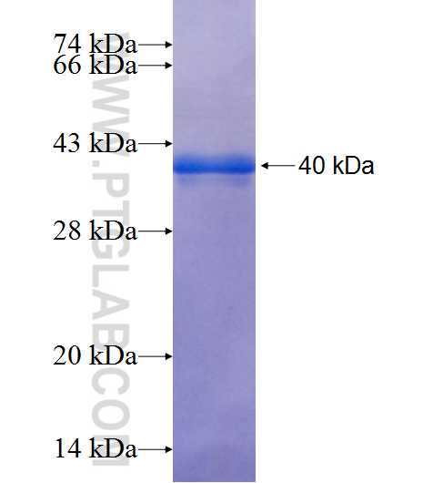 SUSD4 fusion protein Ag25346 SDS-PAGE