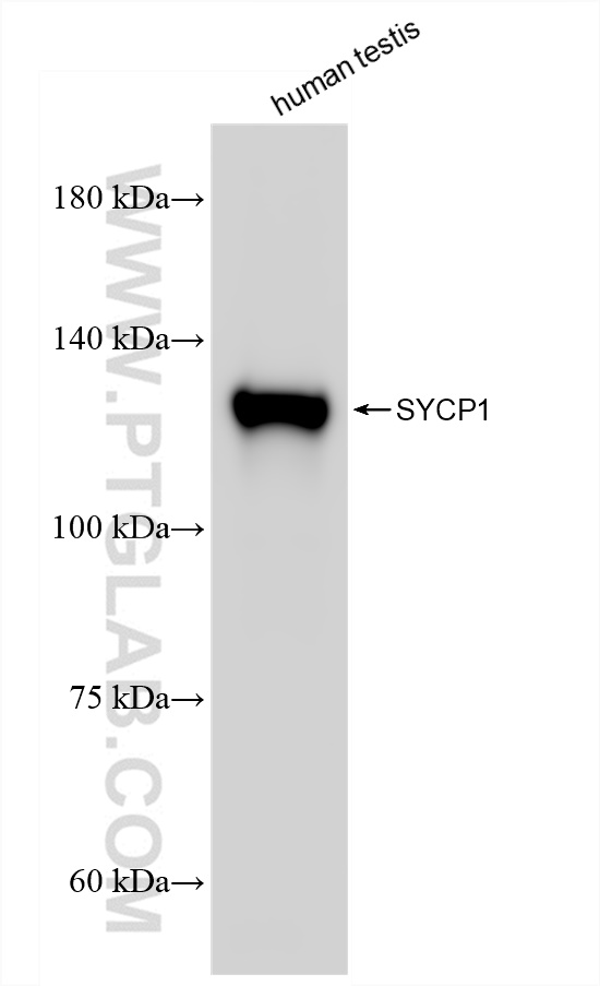 Western Blot (WB) analysis of human testis tissue using SYCP1 Recombinant antibody (83382-2-RR)