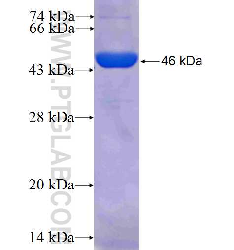 SYMPK fusion protein Ag25112 SDS-PAGE