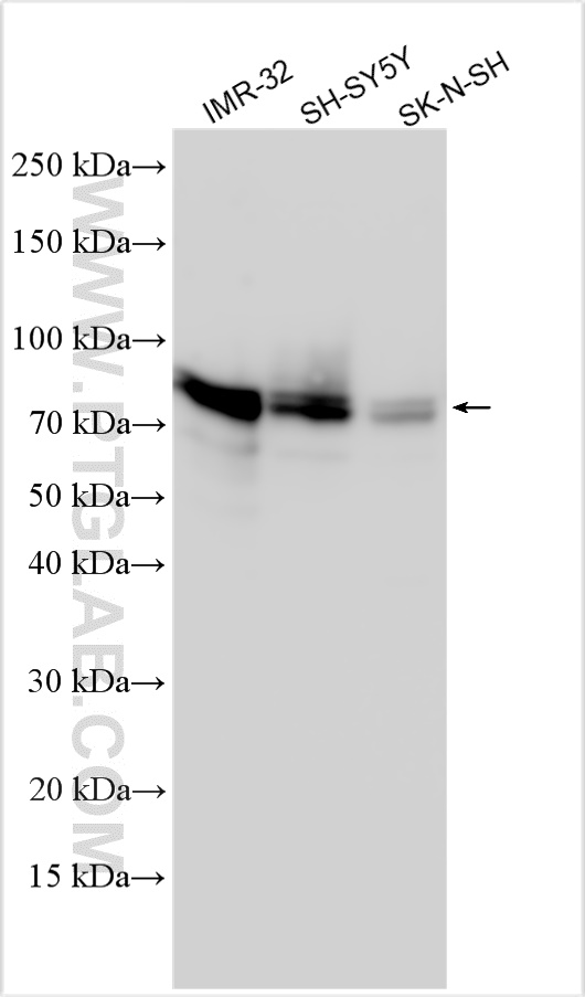 Western Blot (WB) analysis of various lysates using SYN1 Polyclonal antibody (30549-1-AP)