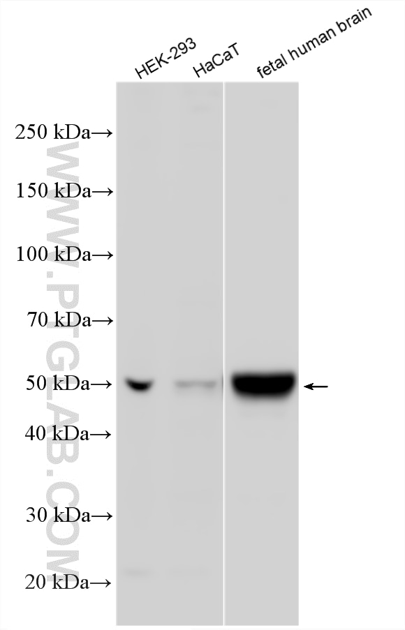 Western Blot (WB) analysis of various lysates using Nesprin 2 Polyclonal antibody (25265-1-AP)