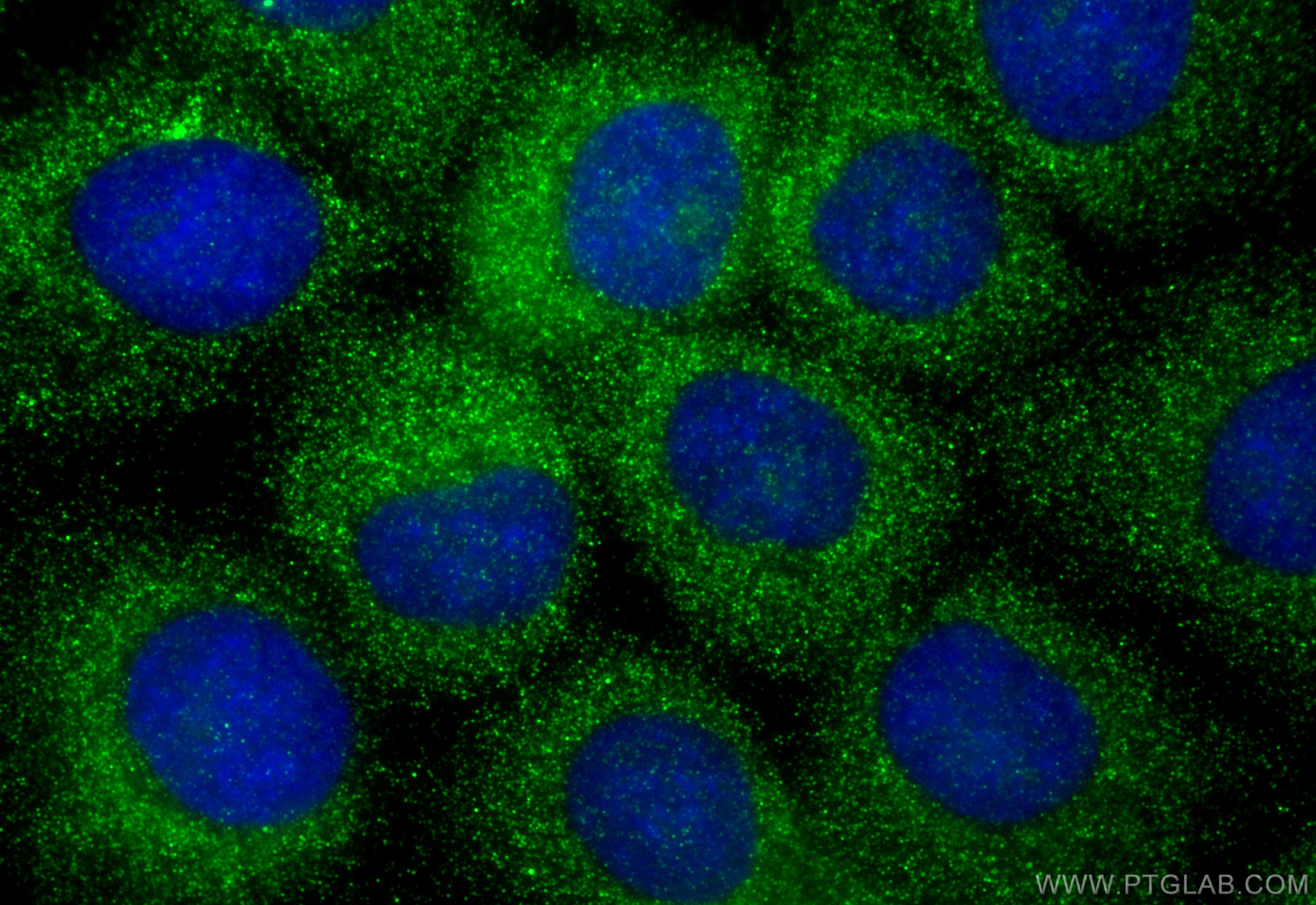 Immunofluorescence (IF) / fluorescent staining of A431 cells using SYNGR1 Polyclonal antibody (10432-1-AP)