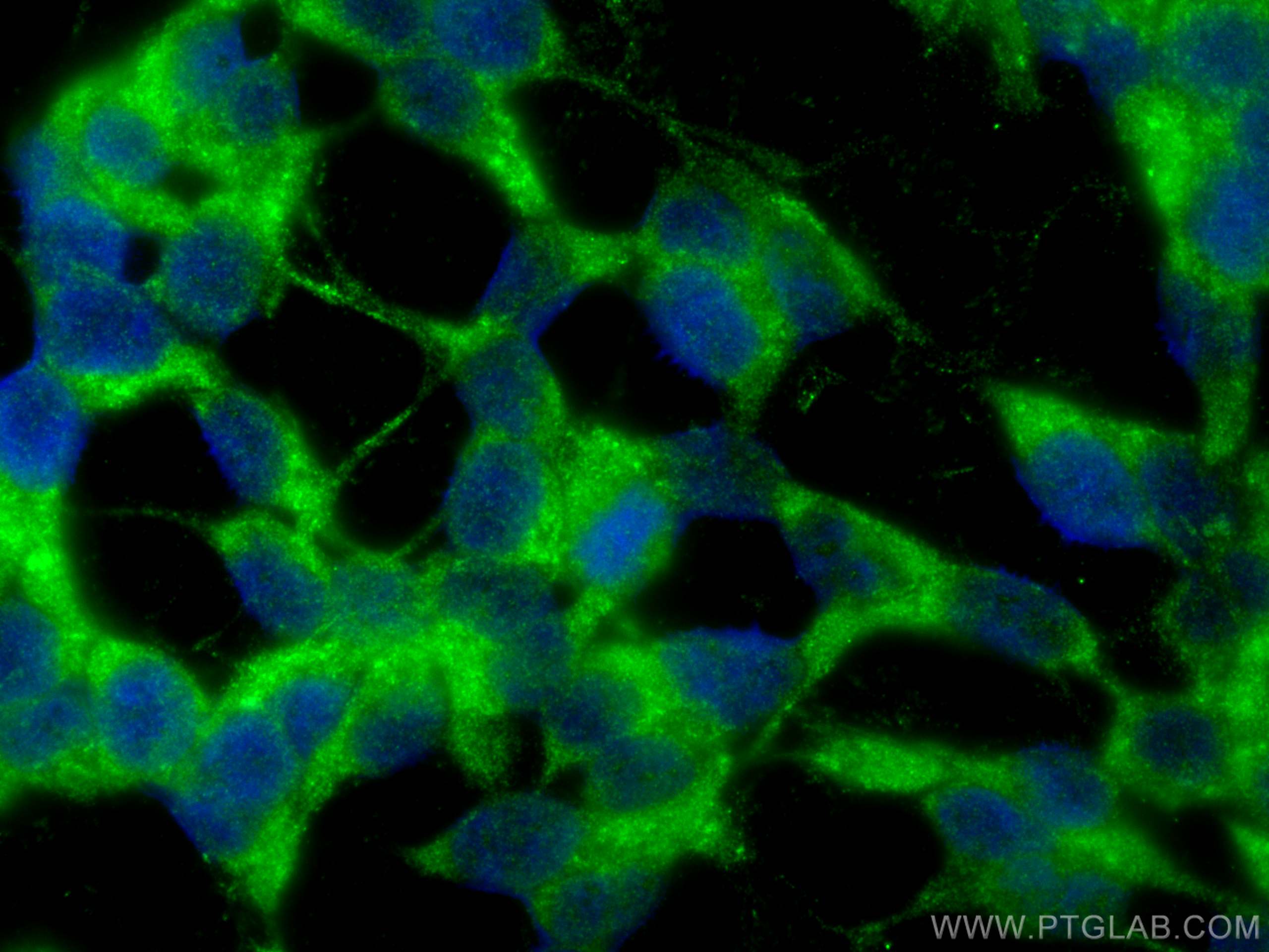 Immunofluorescence (IF) / fluorescent staining of SH-SY5Y cells using Synaptojanin 2 Polyclonal antibody (13893-1-AP)