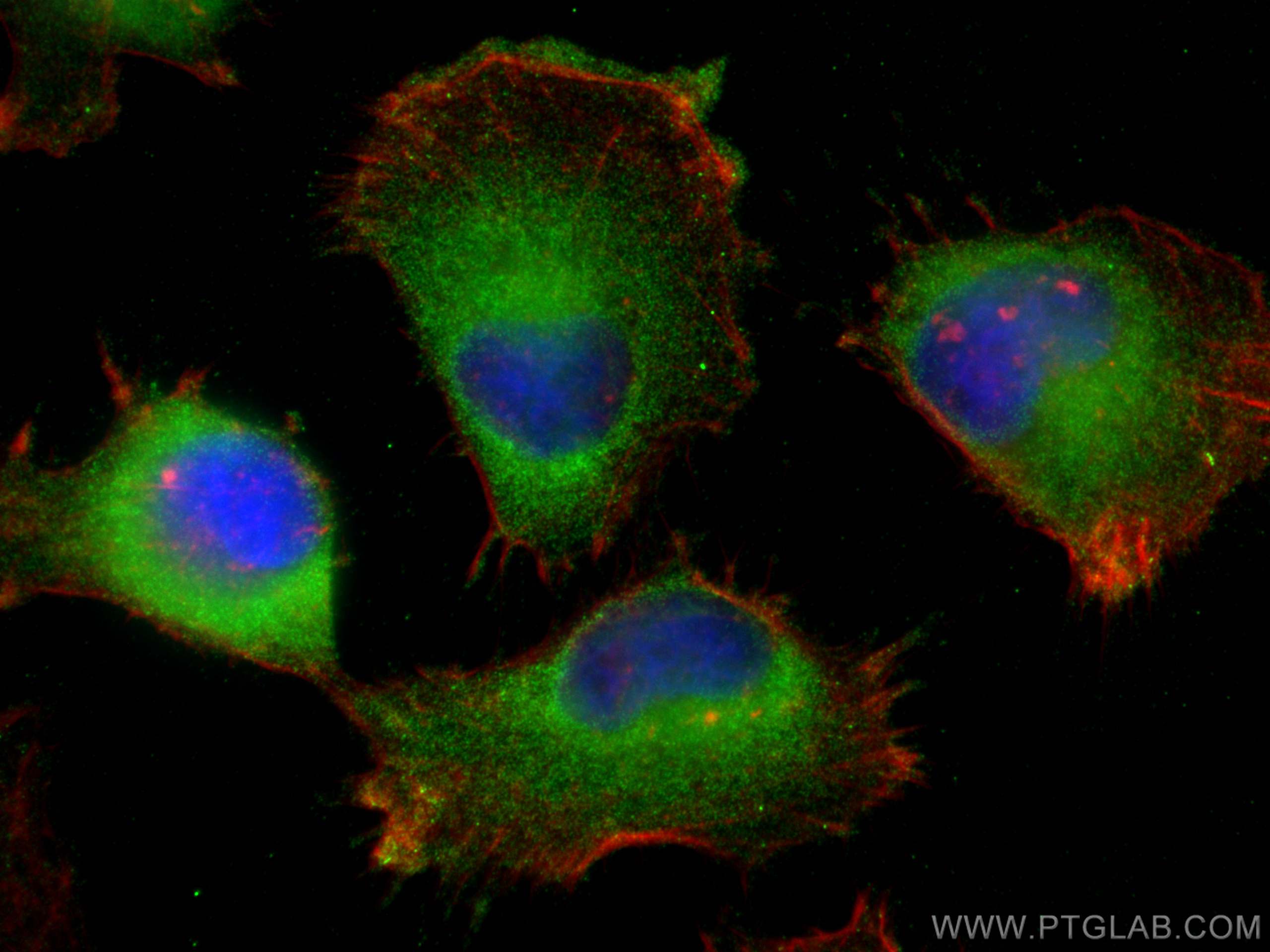 Immunofluorescence (IF) / fluorescent staining of U-251 cells using SYNJ2 Polyclonal antibody (30391-1-AP)