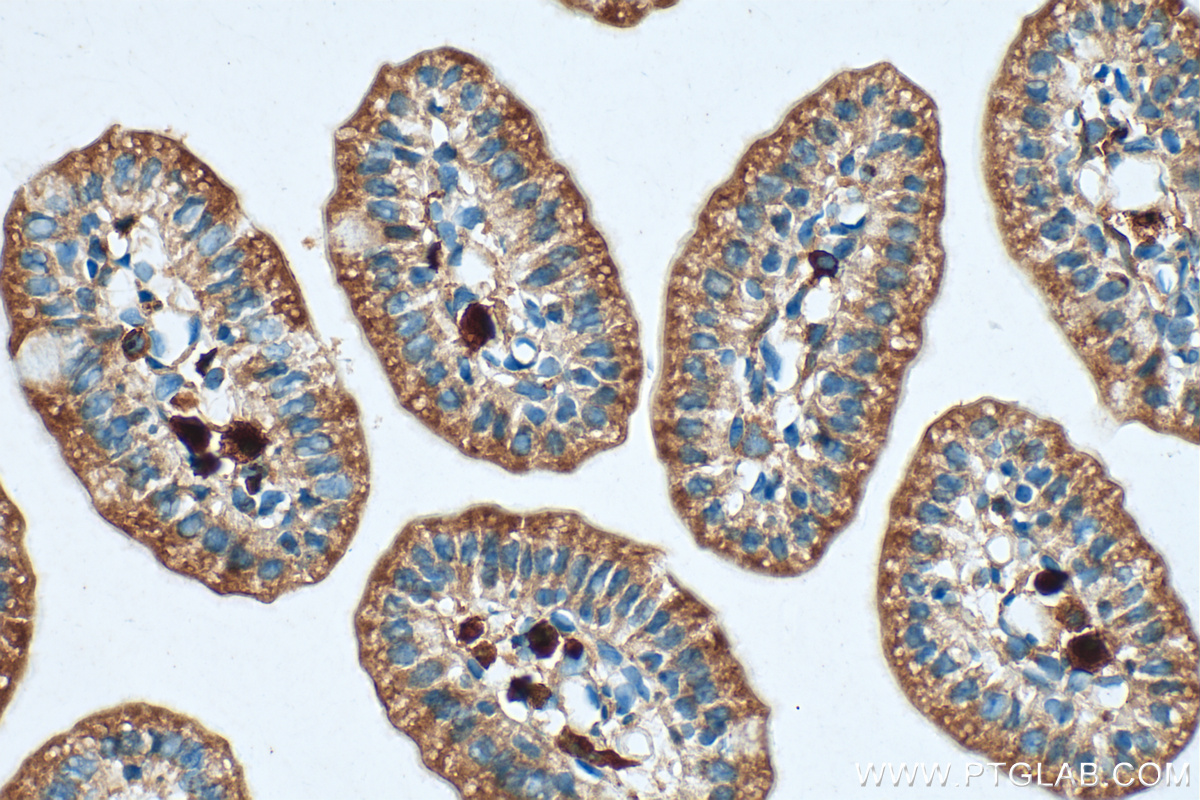 Immunohistochemistry (IHC) staining of mouse small intestine tissue using SYNJ2 Polyclonal antibody (30391-1-AP)