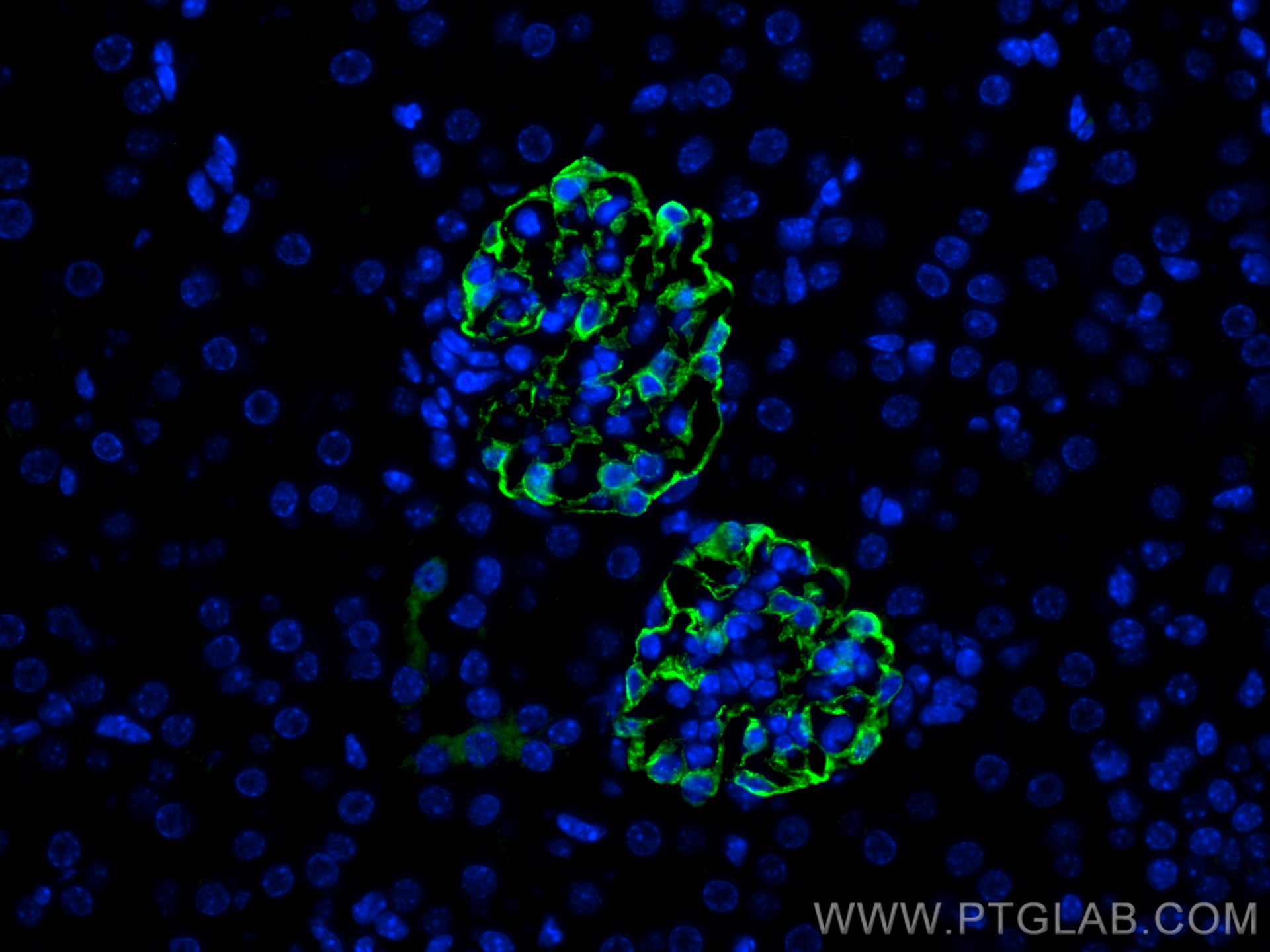 Immunofluorescence (IF) / fluorescent staining of mouse kidney tissue using SYNPO Polyclonal antibody (21064-1-AP)