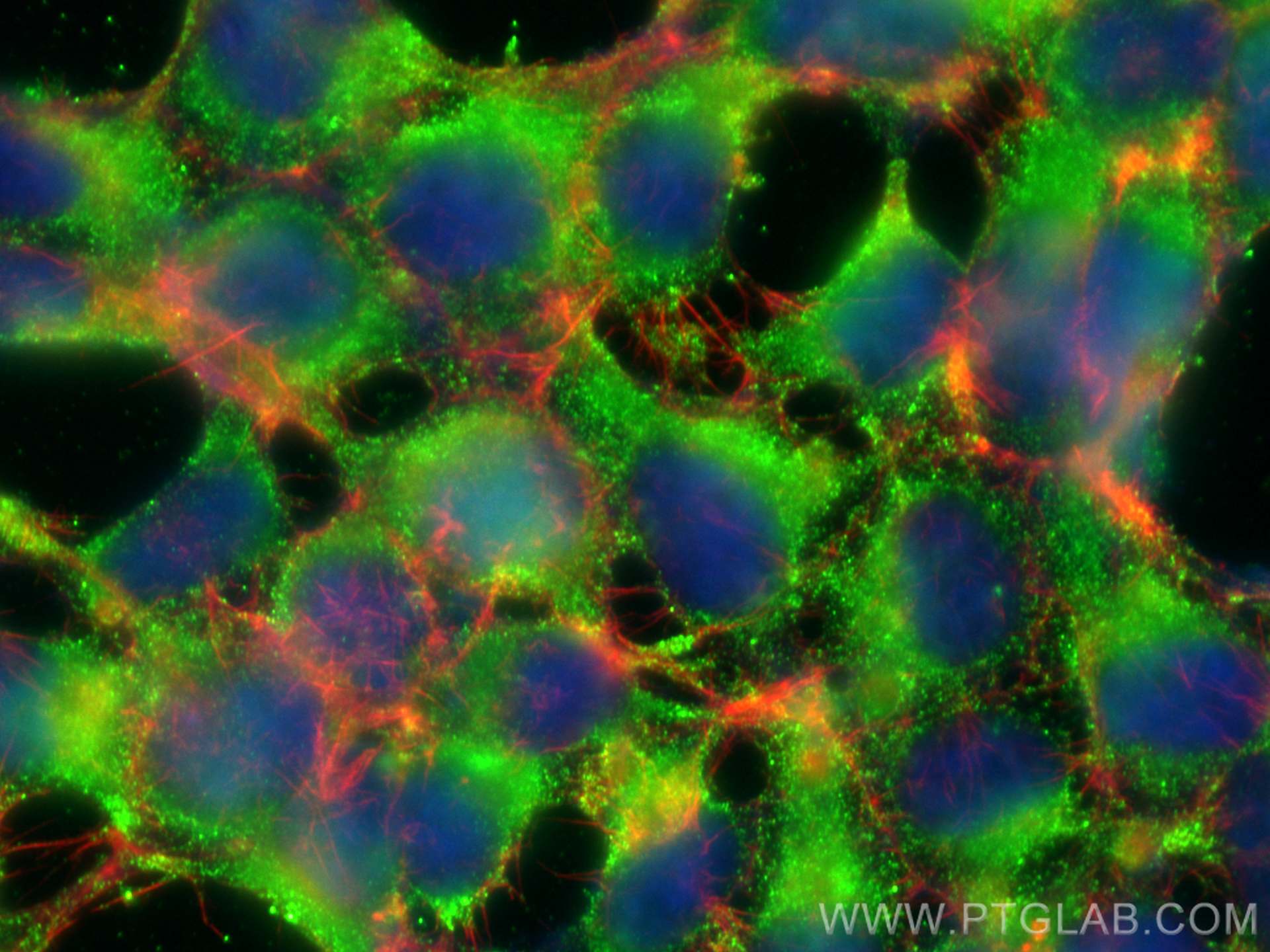 Immunofluorescence (IF) / fluorescent staining of HEK-293 cells using SYNPO Monoclonal antibody (67339-1-Ig)