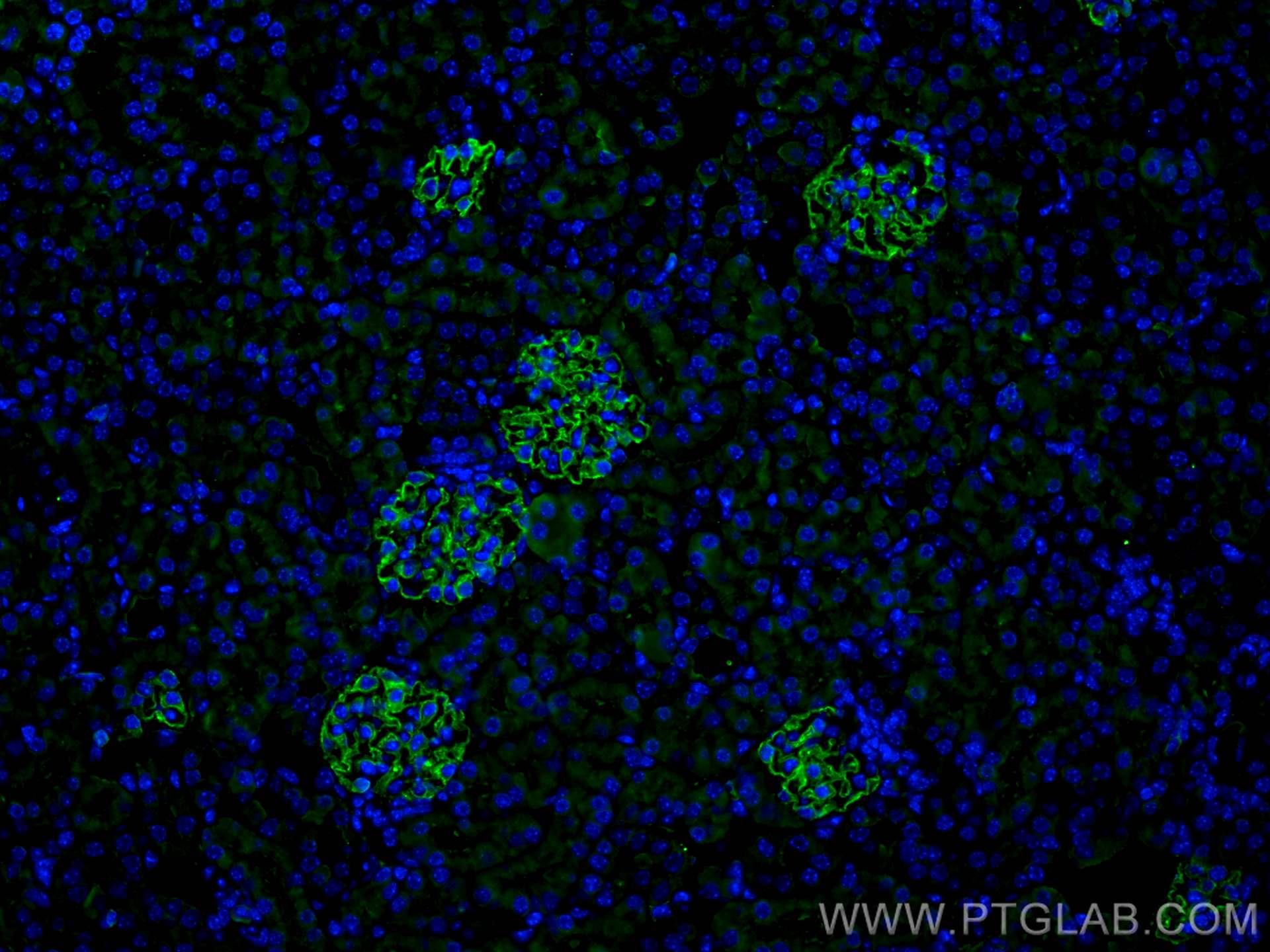 Immunofluorescence (IF) / fluorescent staining of mouse kidney tissue using SYNPO Monoclonal antibody (67339-1-Ig)