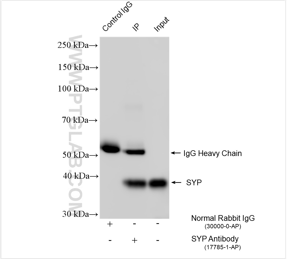 Immunoprecipitation (IP) experiment of mouse brain tissue using Synaptophysin Polyclonal antibody (17785-1-AP)