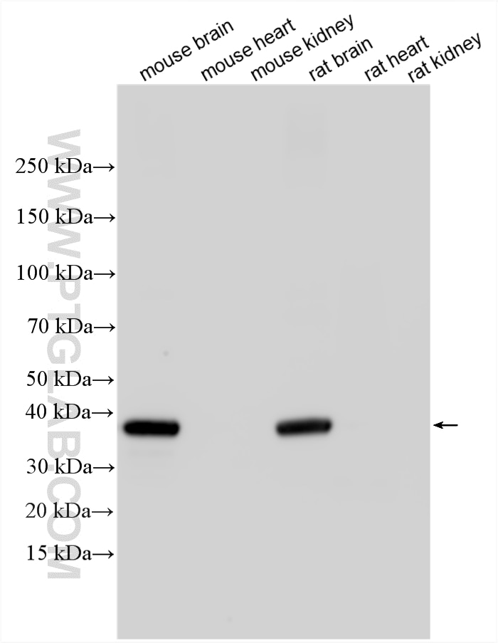 Western Blot (WB) analysis of various lysates using Synaptophysin Polyclonal antibody (17785-1-AP)