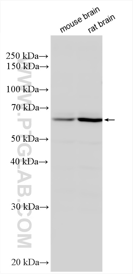 Western Blot (WB) analysis of various lysates using Synaptotagmin-14 Polyclonal antibody (20561-1-AP)