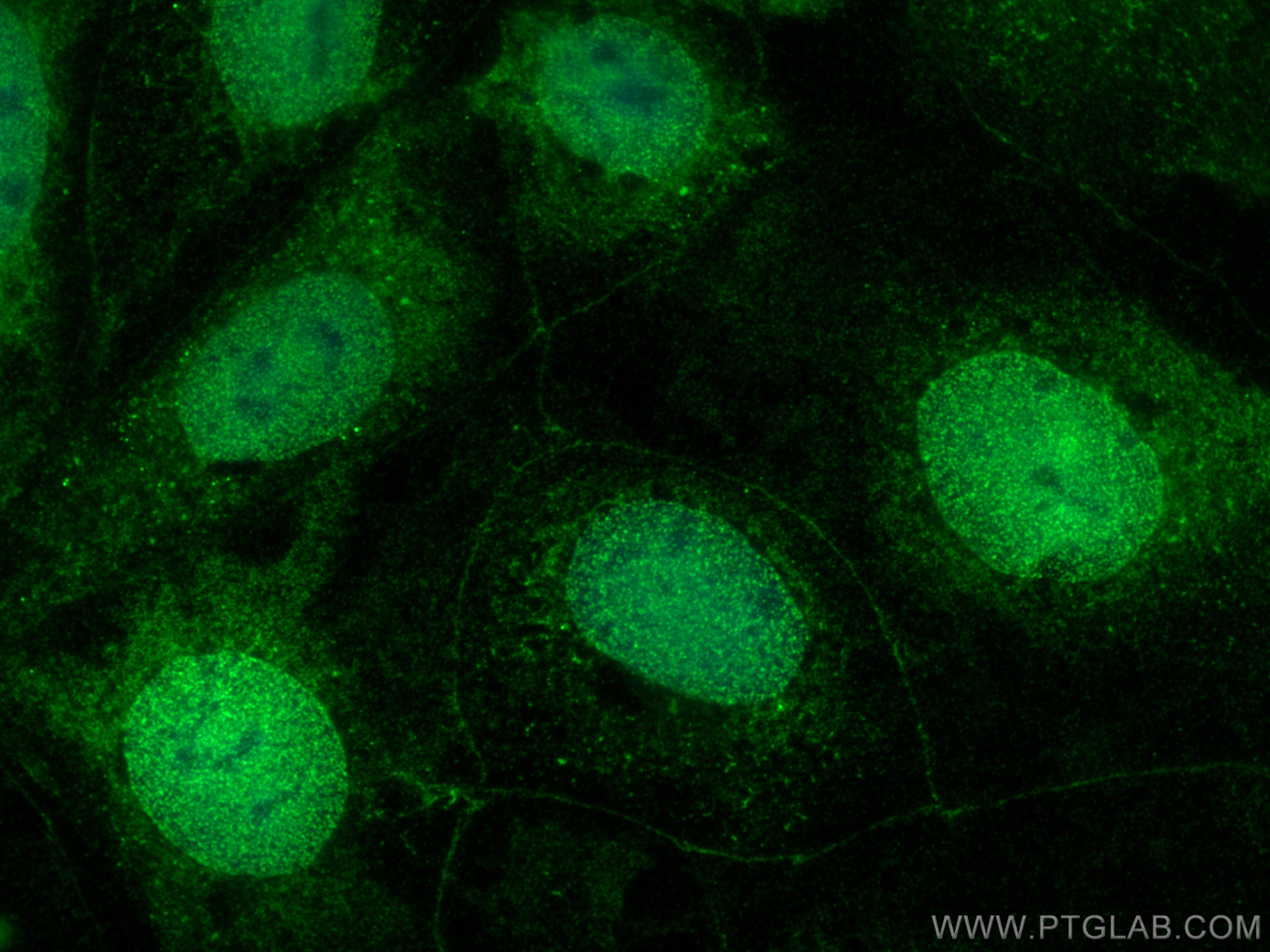 Immunofluorescence (IF) / fluorescent staining of Caco-2 cells using Synaptotagmin-8 Polyclonal antibody (20671-1-AP)