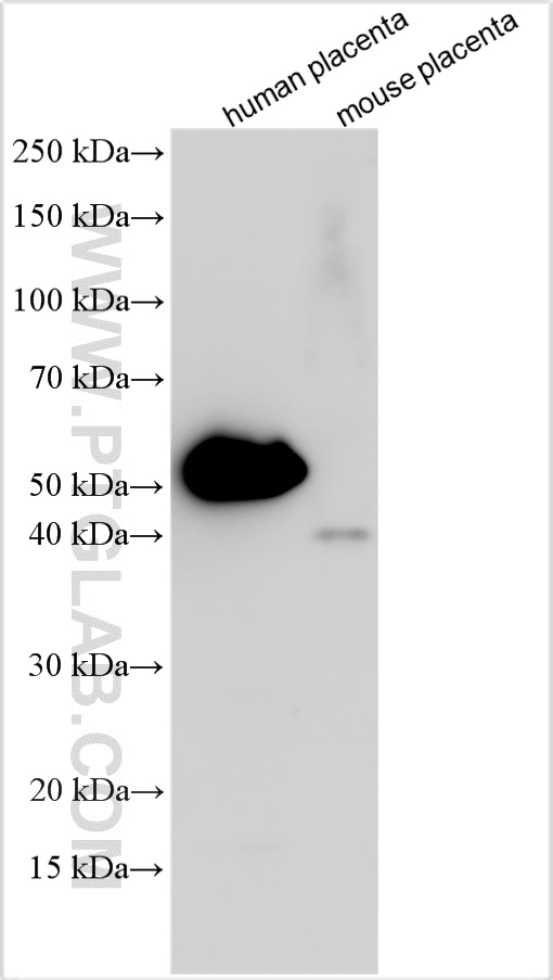 Western Blot (WB) analysis of various lysates using Synaptotagmin-8 Polyclonal antibody (20671-1-AP)