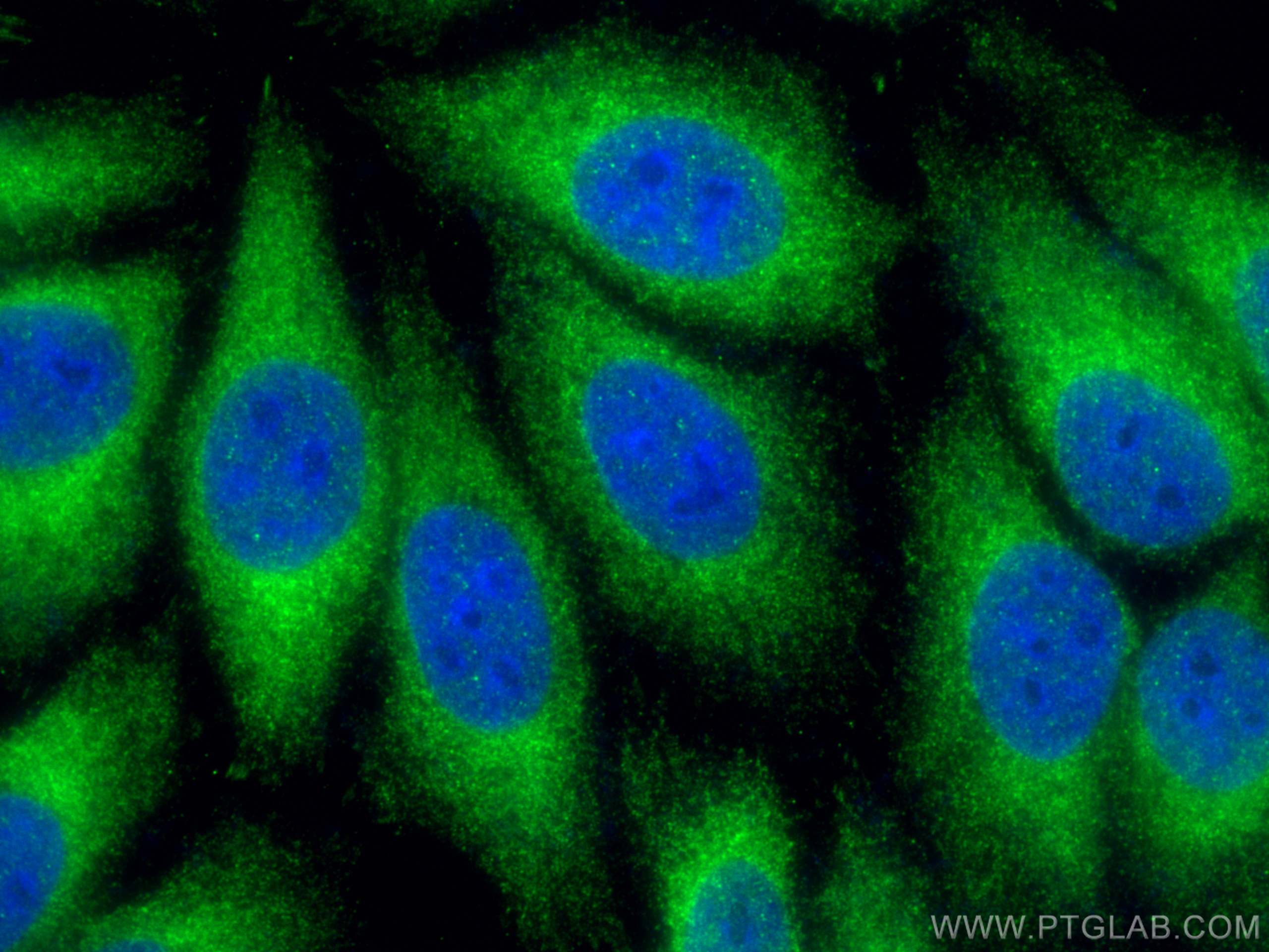 Immunofluorescence (IF) / fluorescent staining of HepG2 cells using HRD1/SYVN1 Polyclonal antibody (13473-1-AP)