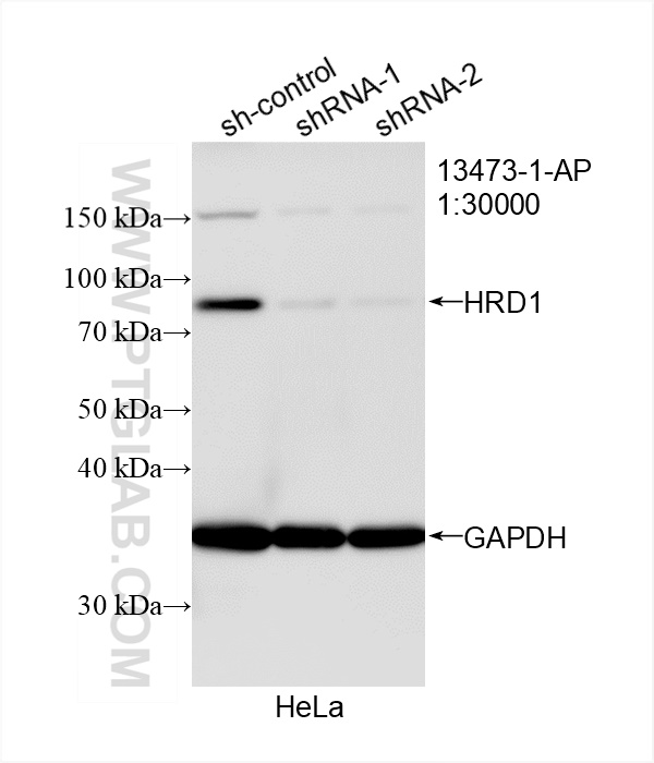 Western Blot (WB) analysis of HeLa cells using HRD1/SYVN1 Polyclonal antibody (13473-1-AP)