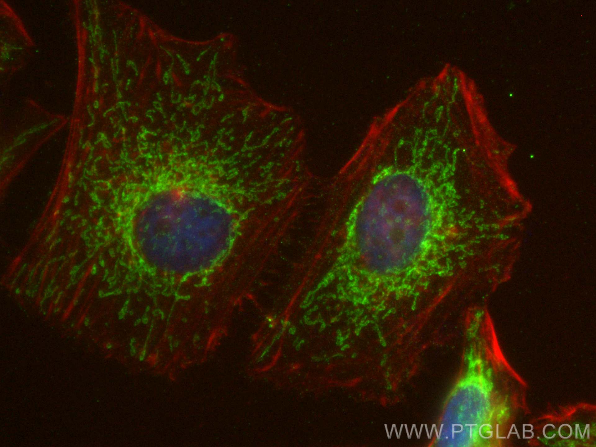 Immunofluorescence (IF) / fluorescent staining of HeLa cells using Sam50 Polyclonal antibody (28679-1-AP)