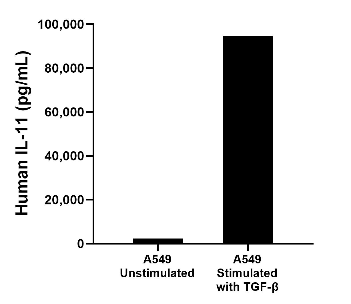 A549 cells were cultured unstimulated or stimulated with 2 ng/mL human TGF-β for 2 days. The mean IL-11 concentration was determined to be 2,309.9 
pg/mL in unstimulated A549 supernatant, 94,433.7 pg/mL in stimulated A549 supernatant. 