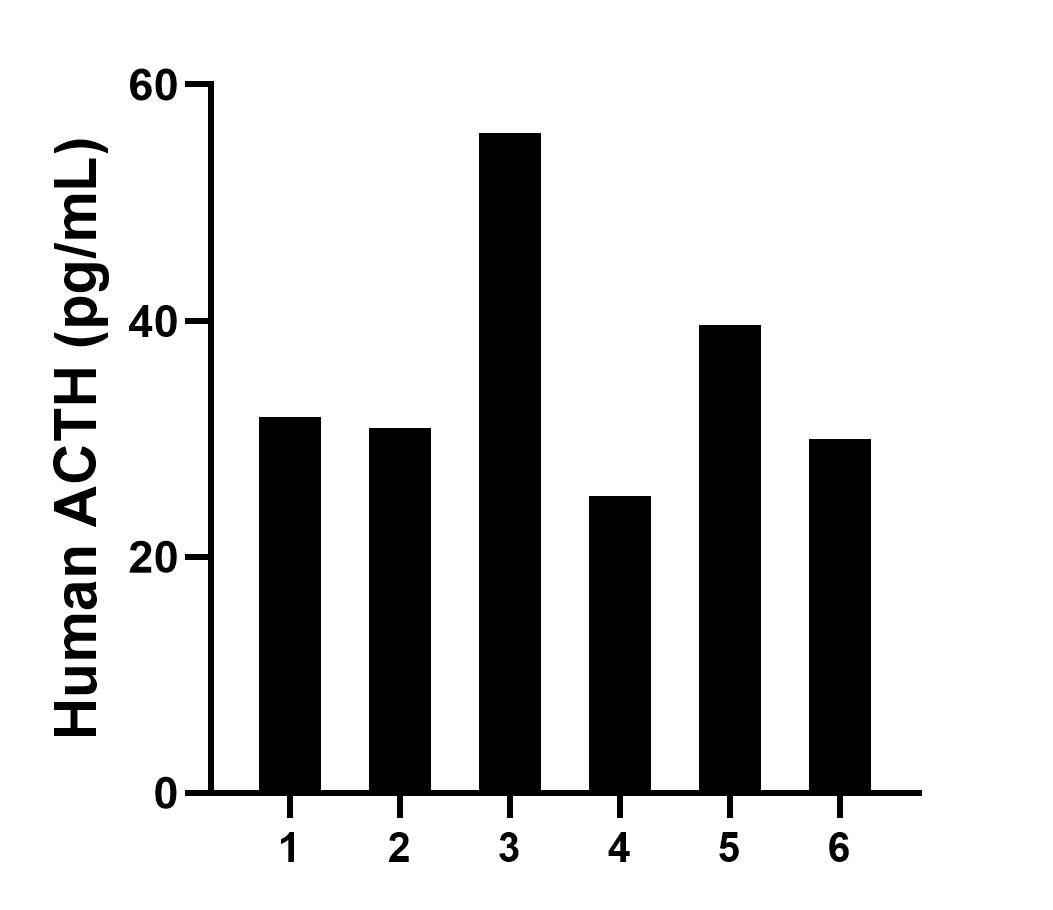 Plasma of six individual healthy human donors was measured. The ACTH concentration of detected samples was determined to be 35.6 pg/mL with a range of 25.1-55.9 pg/mL. Plasma of six individual healthy human donors was measured. The ACTH concentration of detected samples was determined to be 35.6 pg/mL with a range of 25.1-55.9 pg/mL.