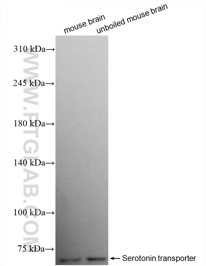 Western Blot (WB) analysis of various lysates using Serotonin transporter Recombinant antibody (84844-3-RR)