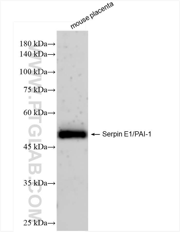 Western Blot (WB) analysis of mouse placenta tissue using Serpin E1/PAI-1 Recombinant antibody (83980-3-RR)