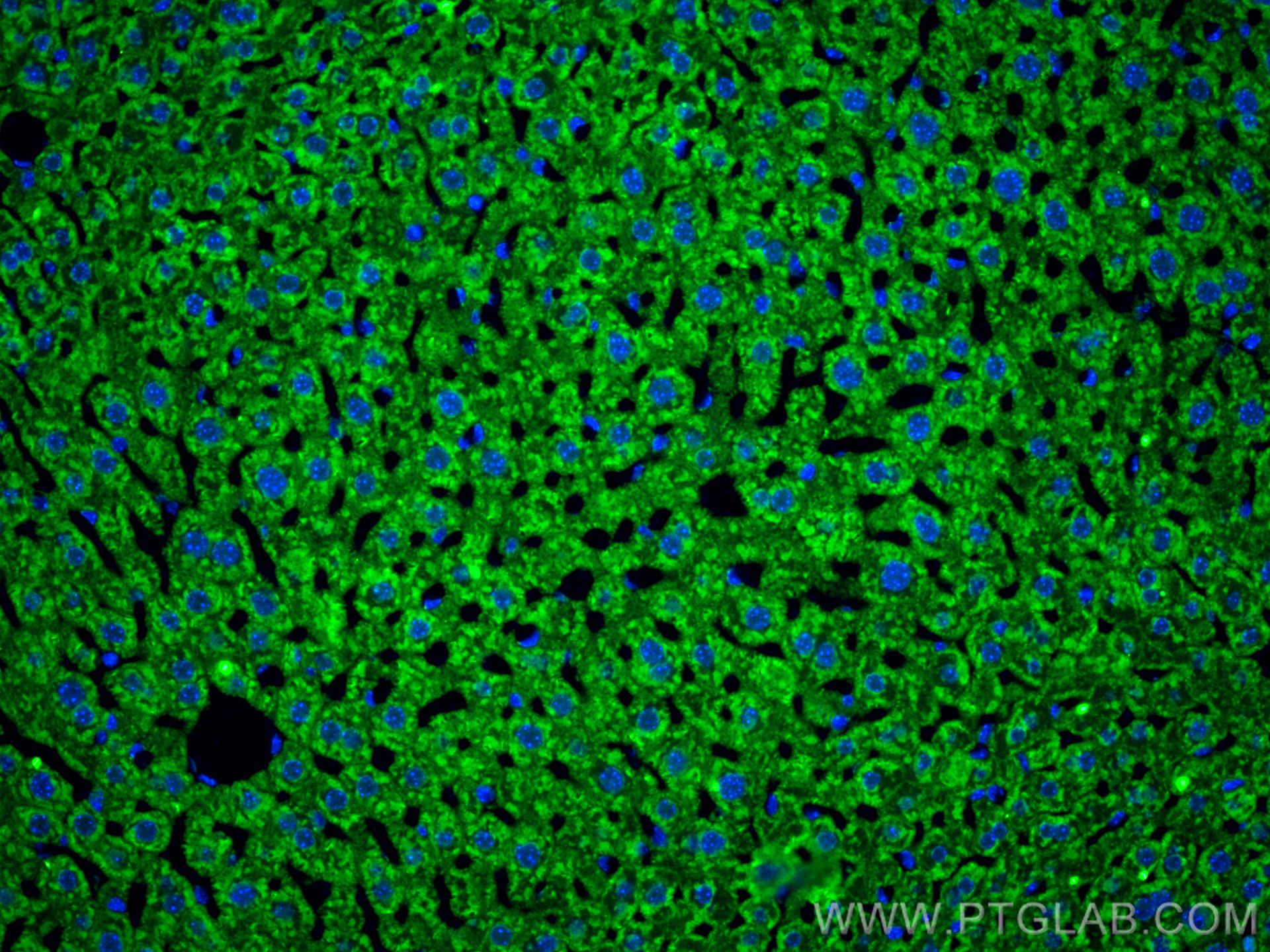 Serum amyloid P component