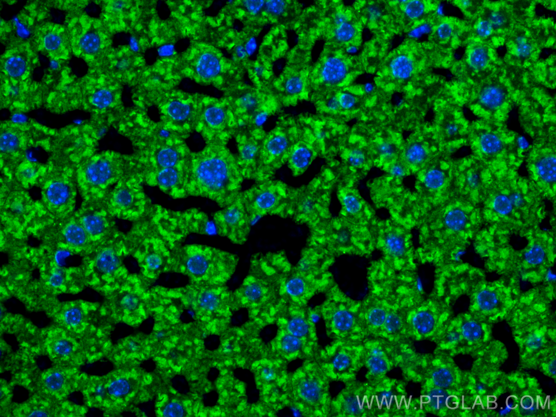 Immunofluorescence (IF) / fluorescent staining of mouse liver tissue using Serum amyloid P component Polyclonal antibody (31813-1-AP)