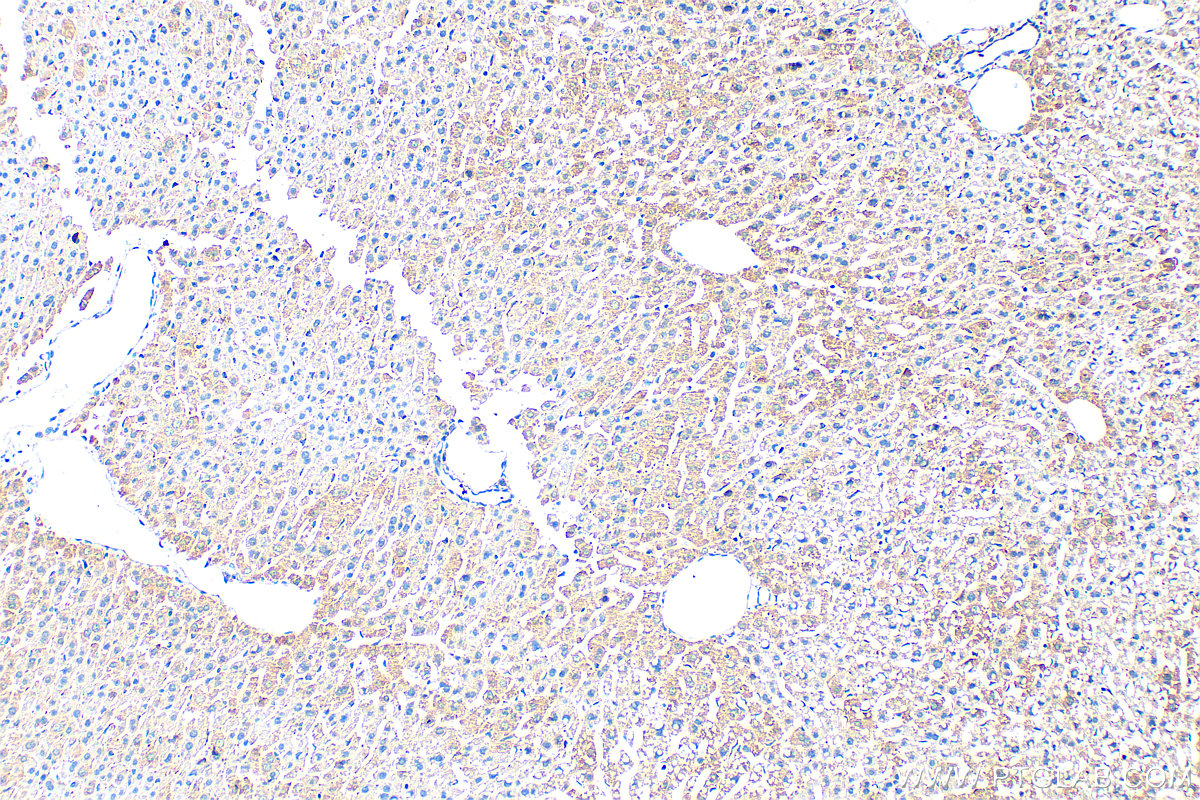 Immunohistochemistry (IHC) staining of mouse liver tissue using Serum amyloid P component Polyclonal antibody (31813-1-AP)