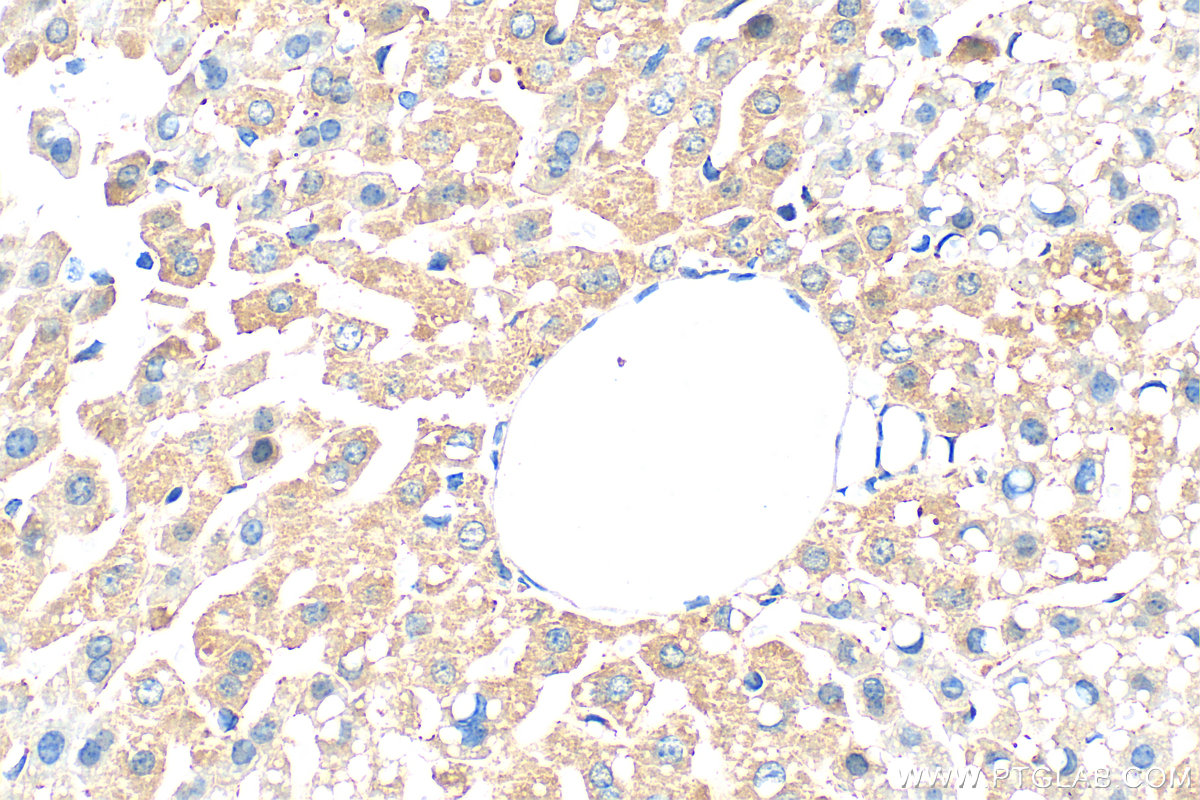 Immunohistochemistry (IHC) staining of mouse liver tissue using Serum amyloid P component Polyclonal antibody (31813-1-AP)