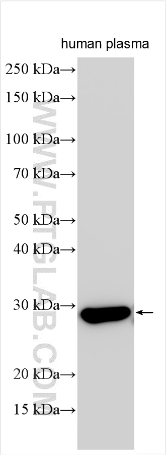 Serum amyloid P component