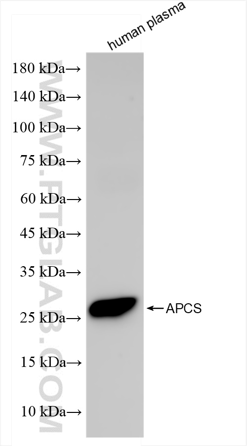 Western Blot (WB) analysis of human plasma using Serum amyloid P component Recombinant antibody (84402-1-RR)