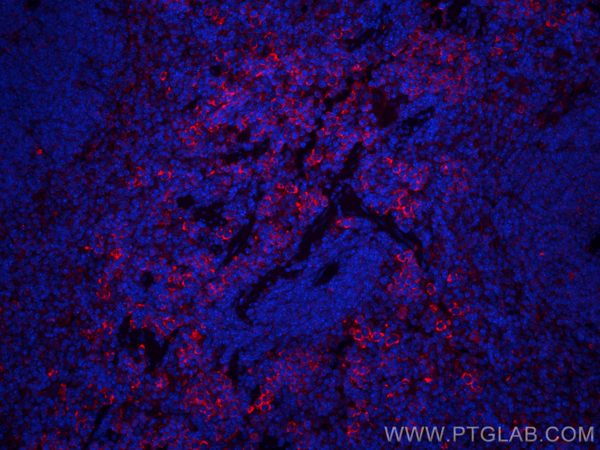 Immunofluorescence (IF) / fluorescent staining of mouse spleen tissue using CoraLite®594-conjugated Serum amyloid P component  (CL594-66084)