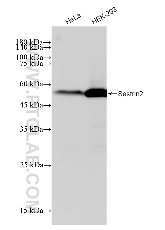 Western Blot (WB) analysis of various lysates using Sestrin 2 Recombinant antibody (83202-3-RR)